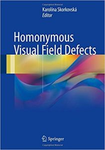 Download: Homonymous Visual Field Defects