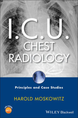 I.C.U. Chest Radiology